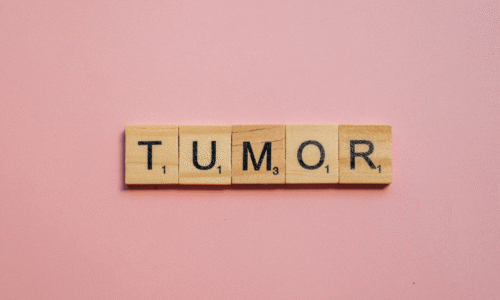 comparing Brain Tumor Grades