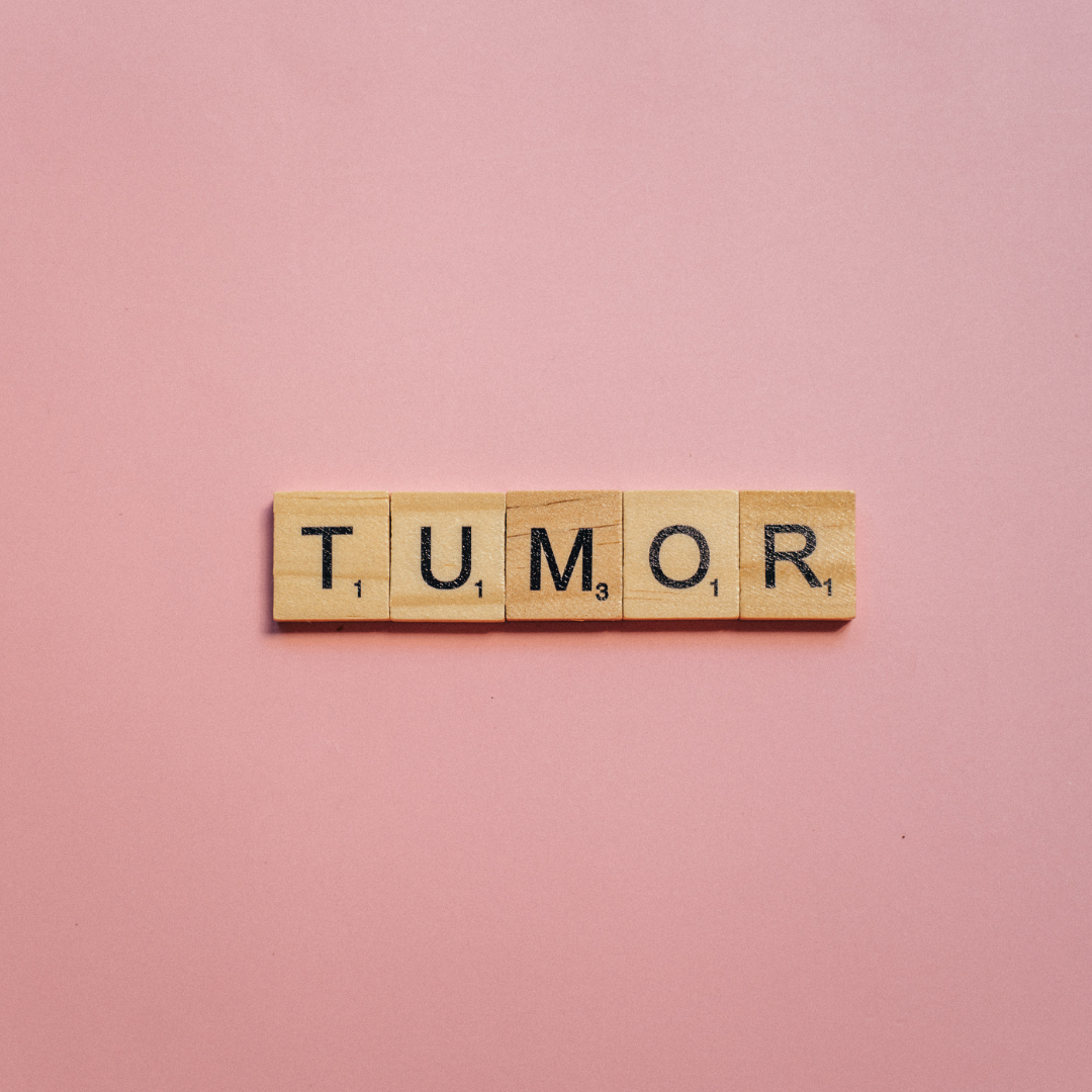 comparing Brain Tumor Grades